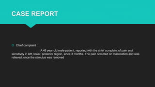 CASE REPORT
 Chief complaint :
A 46 year old male patient, reported with the chief complaint of pain and
sensitivity in left, lower, posterior region, since 3 months. The pain occurred on mastication and was
relieved, once the stimulus was removed
 
