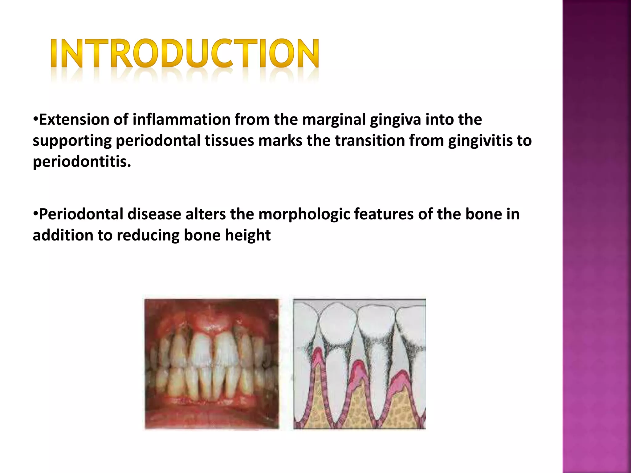 •Extension of inflammation from the marginal gingiva into the
supporting periodontal tissues marks the transition from gingivitis to
periodontitis.
•Periodontal disease alters the morphologic features of the bone in
addition to reducing bone height
 