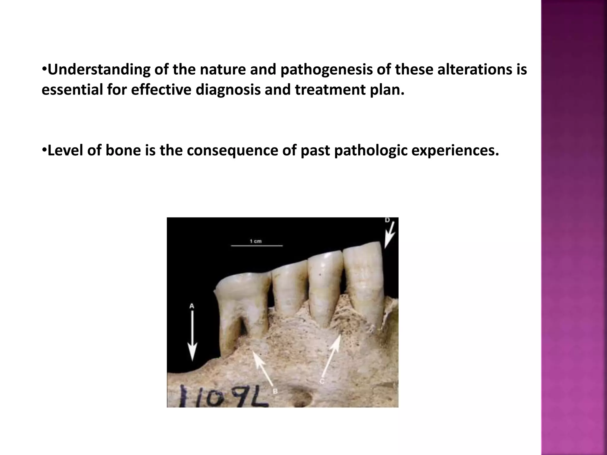 •Understanding of the nature and pathogenesis of these alterations is
essential for effective diagnosis and treatment plan.
•Level of bone is the consequence of past pathologic experiences.
 