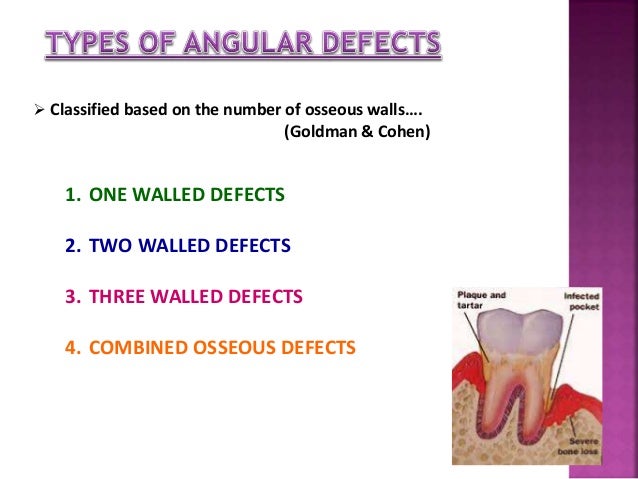 Patterns Of Bone Destruction In Periodontics Patterns Of Bone Destruction In Periodontics