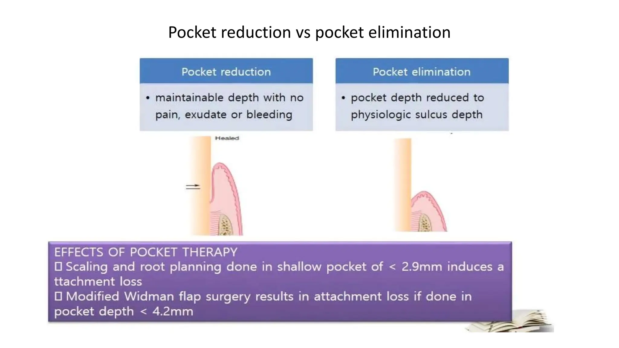 Pocket reduction vs pocket elimination