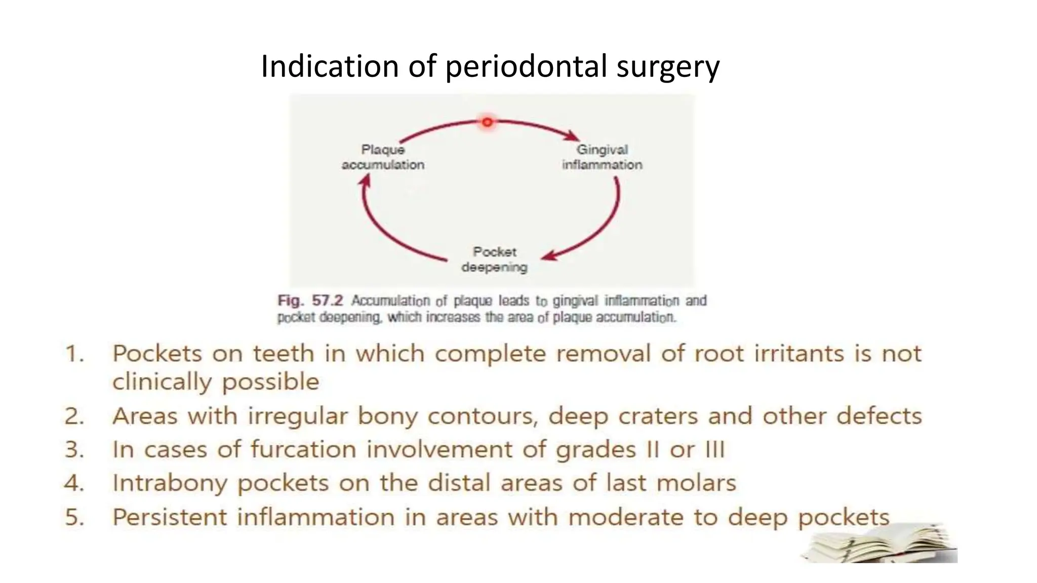 Indication of periodontal surgery
