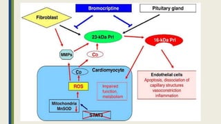 Peripartum cardiomyopathy | PPTX