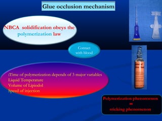 Glue occlusion mechanism
NBCA solidification obeys the
polymerization law
Contact
with blood
Time of polymerization depends of 3 major variables:
Liquid Temperature
Volume of Lipiodol
Speed of injection
Polymerization phenomenon
=
sticking phenomenon
 