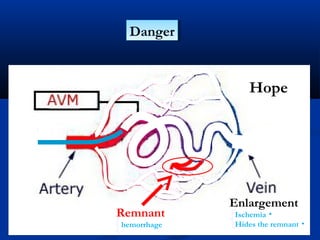 DangerDanger
Hope
Enlargement
Remnant •Ischemia
•Hides the remnanthemorrhage
 