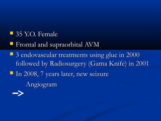  35 Y.O. Female35 Y.O. Female
 Frontal and supraorbital AVMFrontal and supraorbital AVM
 3 endovascular treatments using glue in 20003 endovascular treatments using glue in 2000
followed by Radiosurgery (Gama Knife) in 2001followed by Radiosurgery (Gama Knife) in 2001
 In 2008, 7 years later, new seizureIn 2008, 7 years later, new seizure
AngiogramAngiogram
 