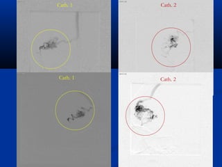 Cath. 1 Cath. 2
Cath. 1 Cath. 2
 