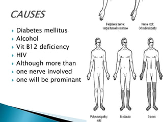  Diabetes mellitus
 Alcohol
 Vit B12 deficiency
 HIV
 Although more than
 one nerve involved
 one will be prominant
 