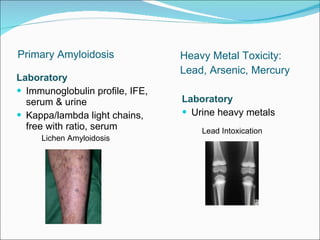 Primary Amyloidosis Heavy Metal Toxicity: Lead, Arsenic, Mercury Laboratory Immunoglobulin profile, IFE, serum & urine  Kappa/lambda light chains, free with ratio, serum Lichen Amyloidosis Laboratory Urine heavy metals Lead Intoxication 