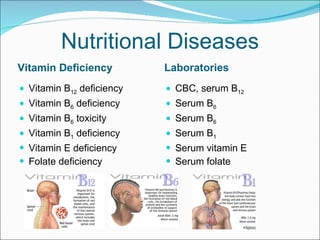 Nutritional Diseases Vitamin Deficiency Laboratories Vitamin B 12  deficiency Vitamin B 6  deficiency Vitamin B 6  toxicity Vitamin B 1  deficiency Vitamin E deficiency Folate deficiency CBC, serum B 12   Serum B 6   Serum B 6   Serum B 1   Serum vitamin E  Serum folate 