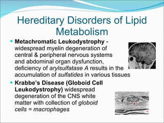Hereditary Disorders of Lipid Metabolism Metachromatic Leukodystrophy  -  widespread myelin degeneration of  central & peripheral nervous systems  and abdominal organ dysfunction,  deficiency of  arylsulfatase A  results in the accumulation of  sulfatides  in various tissues Krabbe’s Disease (Globoid Cell  Leukodystrophy)  widespread  degeneration of the CNS white  matter with collection of  globoid  cells = macrophages  