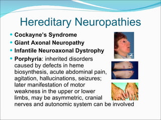 Hereditary Neuropathies Cockayne’s Syndrome Giant Axonal Neuropathy Infantile Neuroaxonal Dystrophy Porphyria :   inherited disorders  caused by defects in heme  biosynthesis, acute abdominal pain,  agitation, hallucinations, seizures;  later manifestation of motor  weakness in the upper or lower  limbs, may be asymmetric, cranial  nerves and autonomic system can be involved 