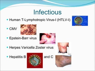 Infectious Human T-Lymphotropic Virus-I (HTLV-I) CMV Epstein-Barr virus Herpes Varicella Zoster virus Hepatitis B  and C 