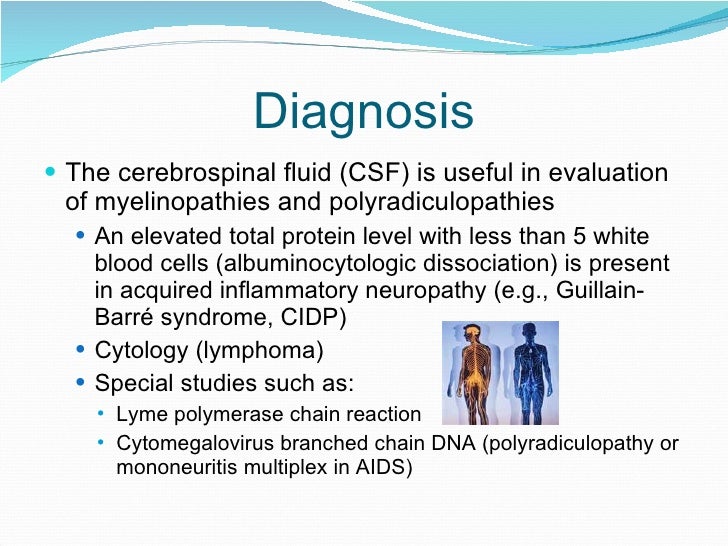 Peripheral Neuropathy an overview