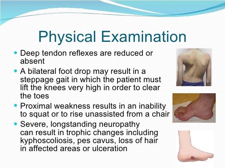Peripheral Neuropathy an overview