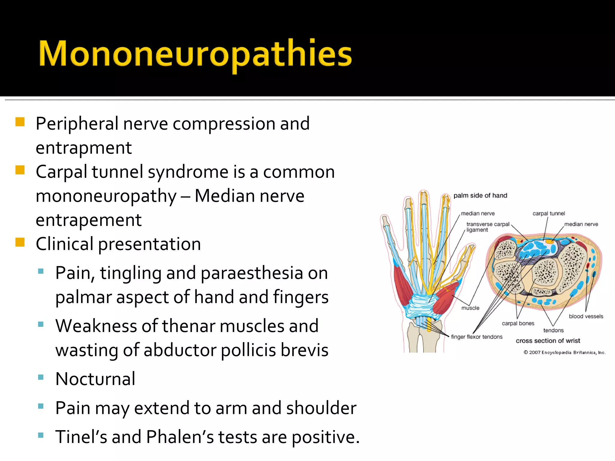  Peripheral nerve compression and
entrapment
 Carpal tunnel syndrome is a common
mononeuropathy – Median nerve
entrapement
 Clinical presentation
 Pain, tingling and paraesthesia on
palmar aspect of hand and fingers
 Weakness of thenar muscles and
wasting of abductor pollicis brevis
 Nocturnal
 Pain may extend to arm and shoulder
 Tinel’s and Phalen’s tests are positive.
 