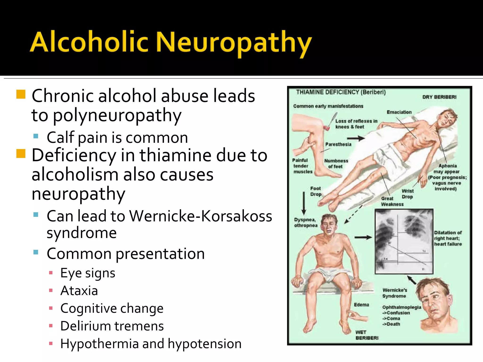  Chronic alcohol abuse leads
to polyneuropathy
 Calf pain is common
 Deficiency in thiamine due to
alcoholism also causes
neuropathy
 Can lead to Wernicke-Korsakoss
syndrome
 Common presentation
▪ Eye signs
▪ Ataxia
▪ Cognitive change
▪ Delirium tremens
▪ Hypothermia and hypotension
 