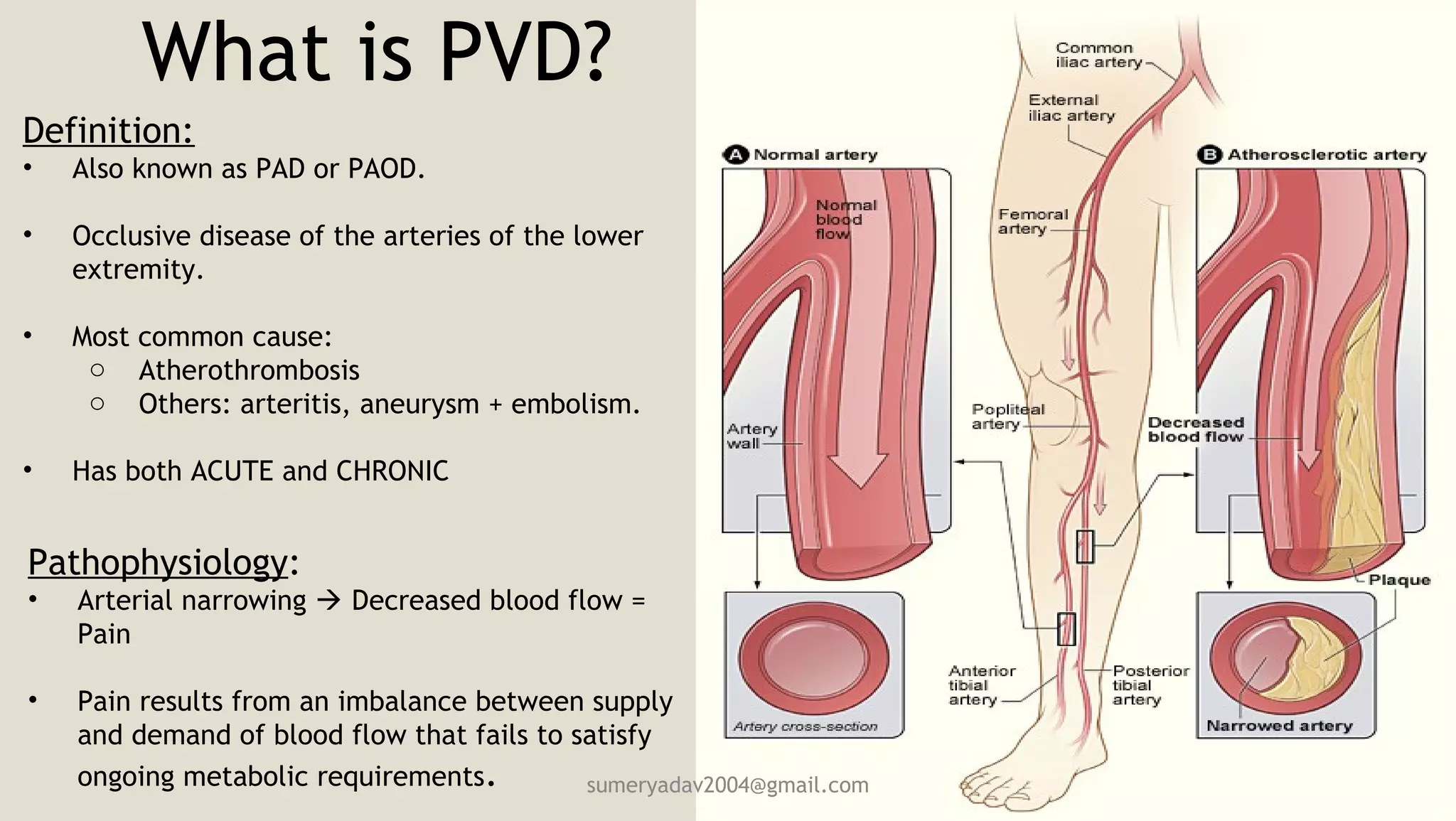 Pvd Def Peripheral vascular disease and Clinical features of acute and chronic ...