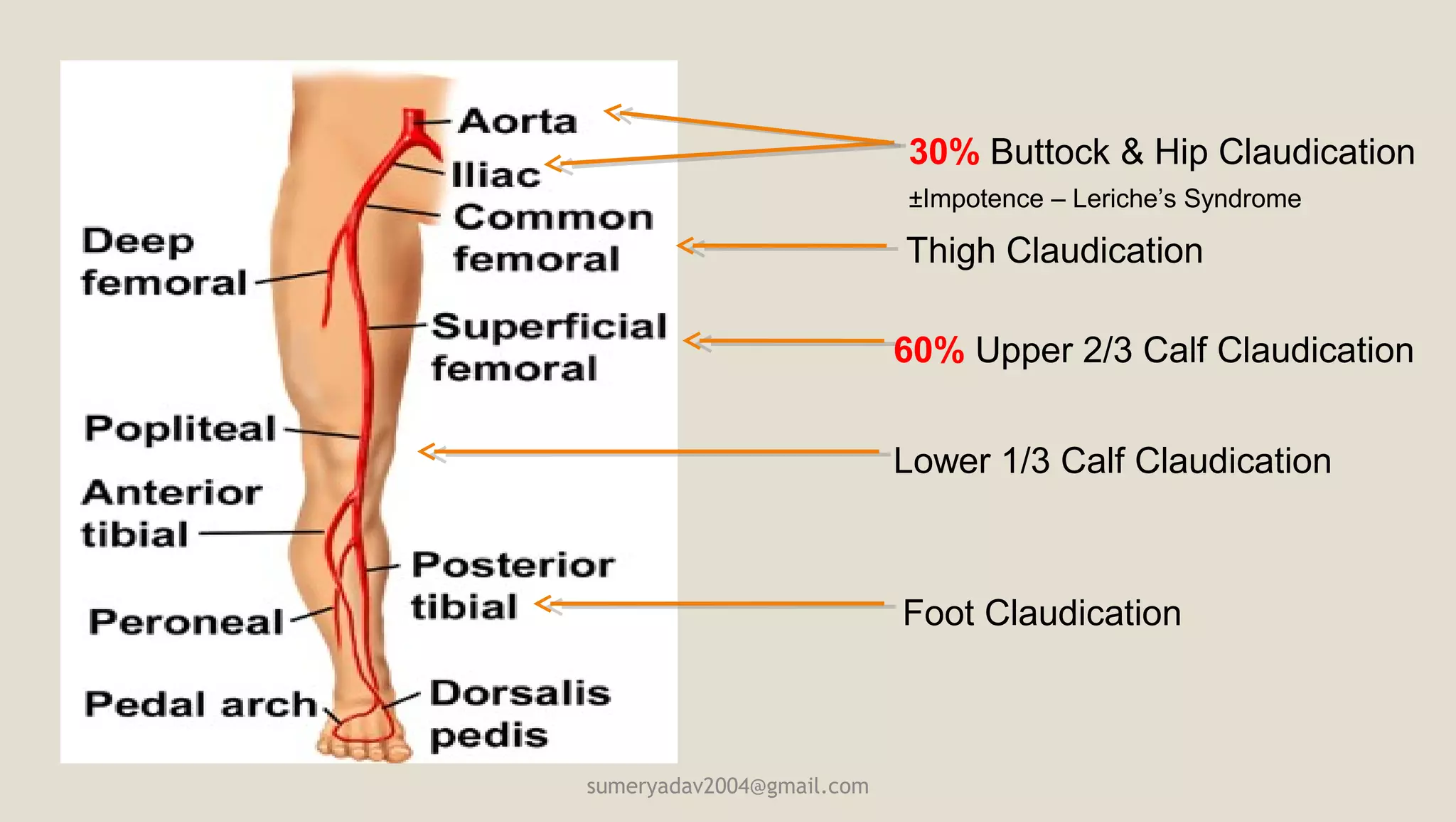 Peripheral vascular disease and Clinical features of acute and chronic ...