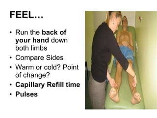 FEEL… Run the  back of your hand  down both limbs Compare Sides Warm or cold? Point of change? Capillary Refill time Pulses 