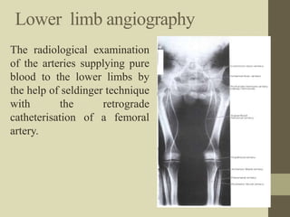 Lower limb angiography
The radiological examination
of the arteries supplying pure
blood to the lower limbs by
the help of seldinger technique
with the retrograde
catheterisation of a femoral
artery.
 