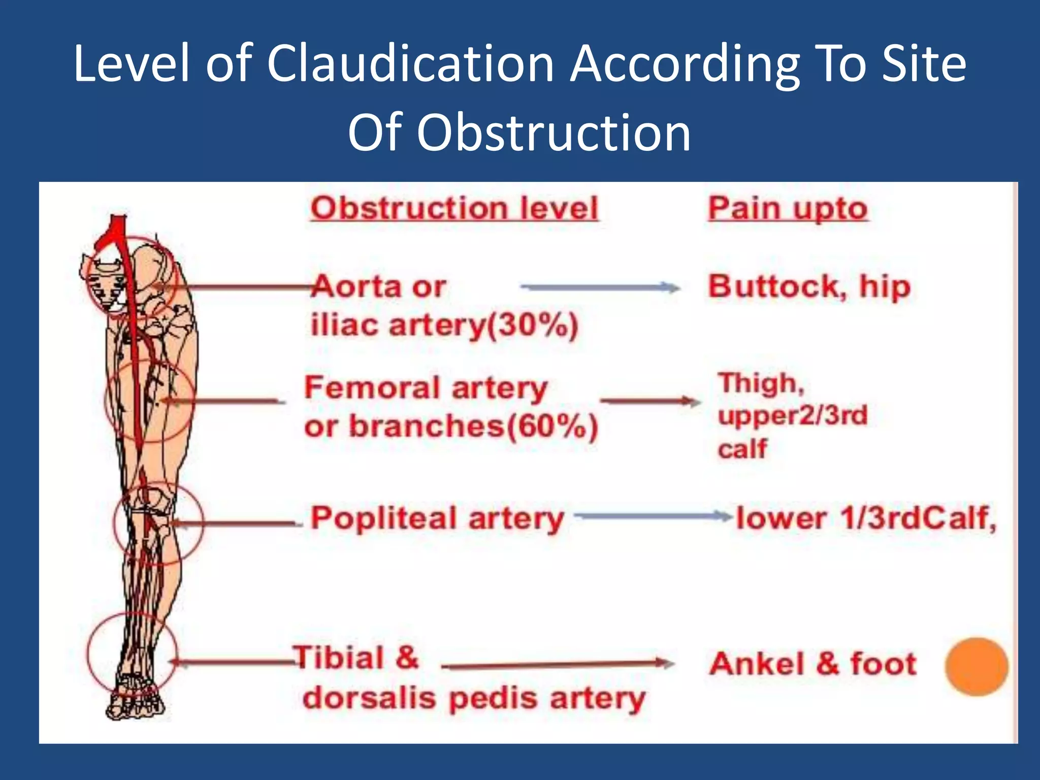 CHRONIC PERIPHERAL ARTERIAL OCCLUSIVE DISEASE | PPTX