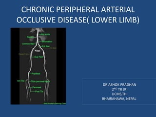 CHRONIC PERIPHERAL ARTERIAL
OCCLUSIVE DISEASE( LOWER LIMB)
DR ASHOK PRADHAN
2ND YR JR
UCMS,TH
BHAIRAHAWA, NEPAL
 