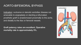 Peripheral Arterial Disease | PPTX