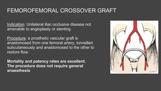 Peripheral Arterial Disease | PPTX