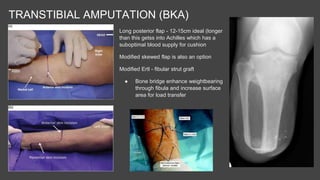 Peripheral Arterial Disease | PPTX