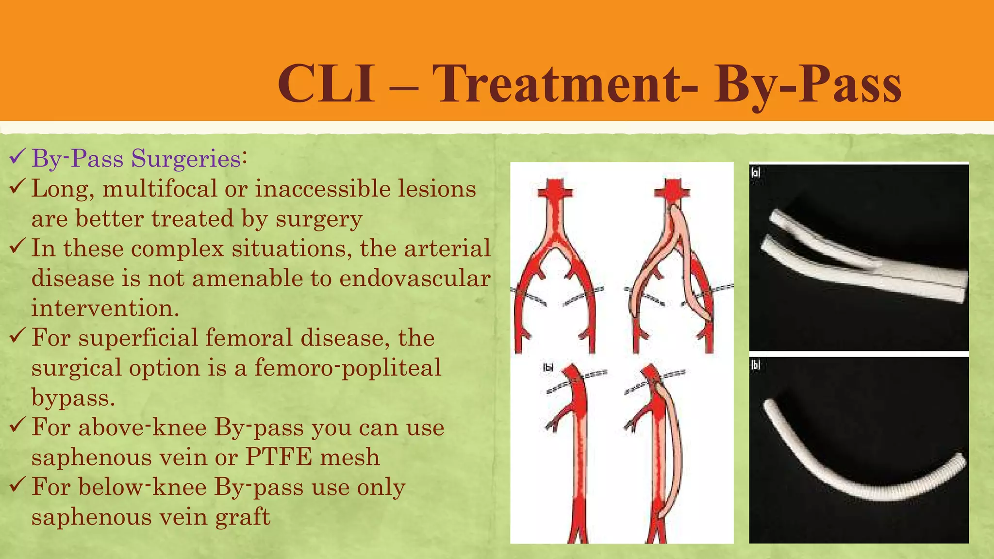 Peripheral arterial diseases | PDF