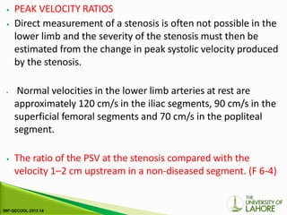 ⦁ PEAK VELOCITY RATIOS
⦁ Direct measurement of a stenosis is often not possible in the
lower limb and the severity of the stenosis must then be
estimated from the change in peak systolic velocity produced
by the stenosis.
⦁ Normal velocities in the lower limb arteries at rest are
approximately 120 cm/s in the iliac segments, 90 cm/s in the
superficial femoral segments and 70 cm/s in the popliteal
segment.
⦁ The ratio of the PSV at the stenosis compared with the
velocity 1–2 cm upstream in a non-diseased segment. (F 6-4)
 