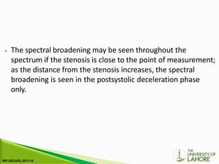⦁ The spectral broadening may be seen throughout the
spectrum if the stenosis is close to the point of measurement;
as the distance from the stenosis increases, the spectral
broadening is seen in the postsystolic deceleration phase
only.
 