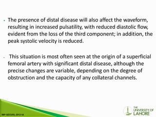 ⦁ The presence of distal disease will also affect the waveform,
resulting in increased pulsatility, with reduced diastolic flow,
evident from the loss of the third component; in addition, the
peak systolic velocity is reduced.
⦁ This situation is most often seen at the origin of a superficial
femoral artery with significant distal disease, although the
precise changes are variable, depending on the degree of
obstruction and the capacity of any collateral channels.
 