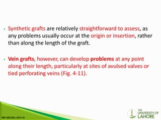 ⦁ Synthetic grafts are relatively straightforward to assess, as
any problems usually occur at the origin or insertion, rather
than along the length of the graft.
⦁ Vein grafts, however, can develop problems at any point
along their length, particularly at sites of avulsed valves or
tied perforating veins (Fig. 4-11).
 