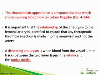 ⦁ The characteristic appearance is a hypoechoic area which
shows swirling blood flow on colour Doppler (Fig. 4-14A).
⦁ It is important that the relationship of the aneurysm to the
femoral artery is identified to ensure that any therapeutic
thrombin injection is made into the aneurysm and not the
artery.
⦁ A dissecting aneurysm is when blood from the vessel lumen
tracks between the two inner layers, the intima and
the tunica media.
 