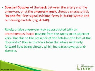 ⦁ Spectral Doppler of the track between the artery and the
aneurysm, or at the aneurysm neck, shows a characteristic
‘to-and-fro’ flow signal as blood flows in during systole and
out during diastole (Fig. 4-14B).
⦁ Rarely, a false aneurysm may be associated with an
arteriovenous fistula passing from the cavity to an adjacent
vein. The clue to the presence of the fistula is the loss of the
‘to-and-fro’ flow in the track from the artery, with only
forward flow being shown, which increases towards end-
diastole.
 