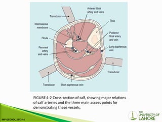 FIGURE 4-2 Cross-section of calf, showing major relations
of calf arteries and the three main access points for
demonstrating these vessels.
 