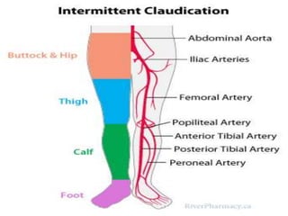 Date Your Footer Here 19
 