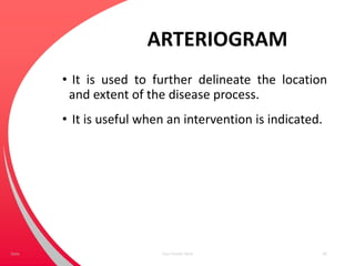ARTERIOGRAM
• It is used to further delineate the location
and extent of the disease process.
• It is useful when an intervention is indicated.
Your Footer Here 40Date
 