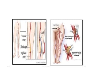 Date Your Footer Here 57
 
