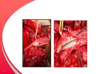 Your Footer Here 60Date
 