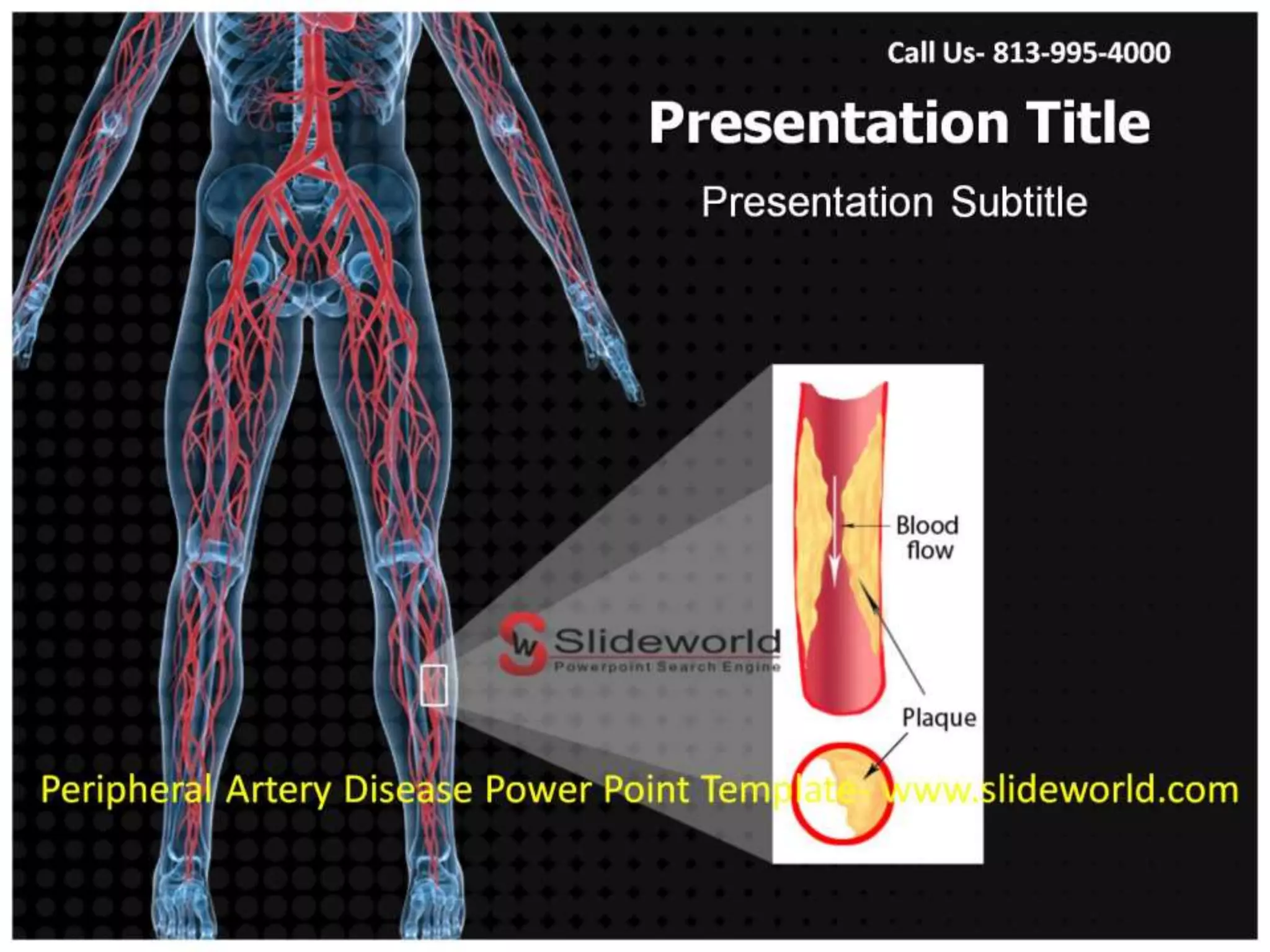Peripheral Artery Disease Powerpoint Template | PPTX