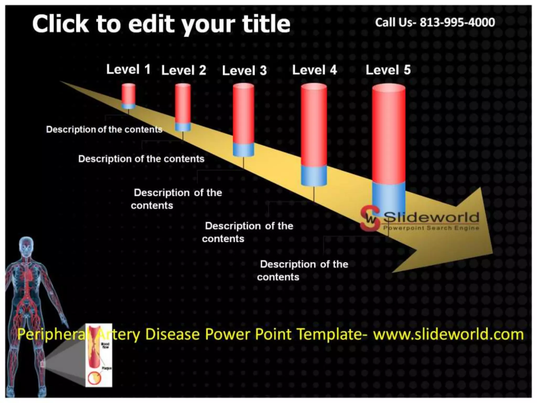 Peripheral Artery Disease Powerpoint Template | PPTX
