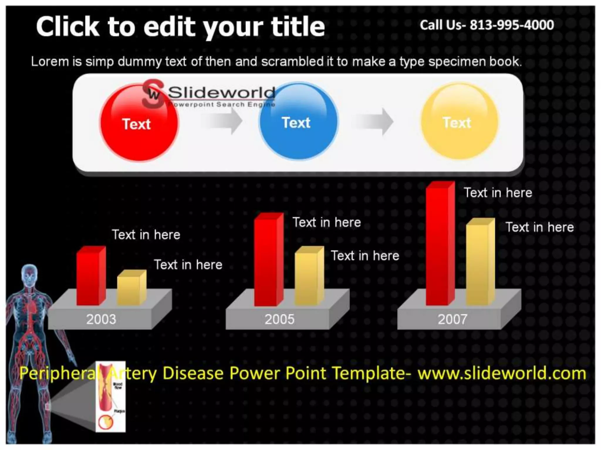 Peripheral Artery Disease Powerpoint Template | PPTX