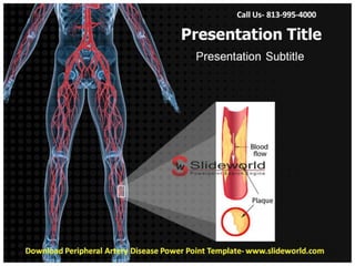 Peripheral artery disease powerpoint template