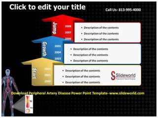Peripheral artery disease powerpoint template | PPTX