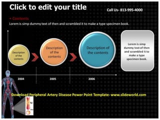 Peripheral artery disease powerpoint template | PPTX