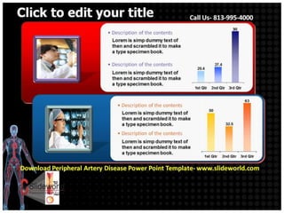 Peripheral artery disease powerpoint template | PPTX