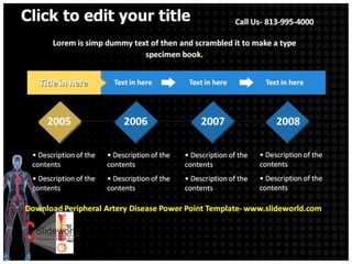Peripheral artery disease powerpoint template | PPTX
